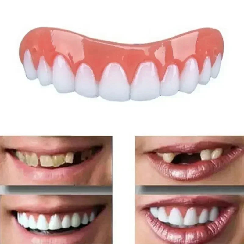 Teeth Whitening Veneers - Neue Silikon-Zahnprothesen für Ober- und Unterkiefer,
