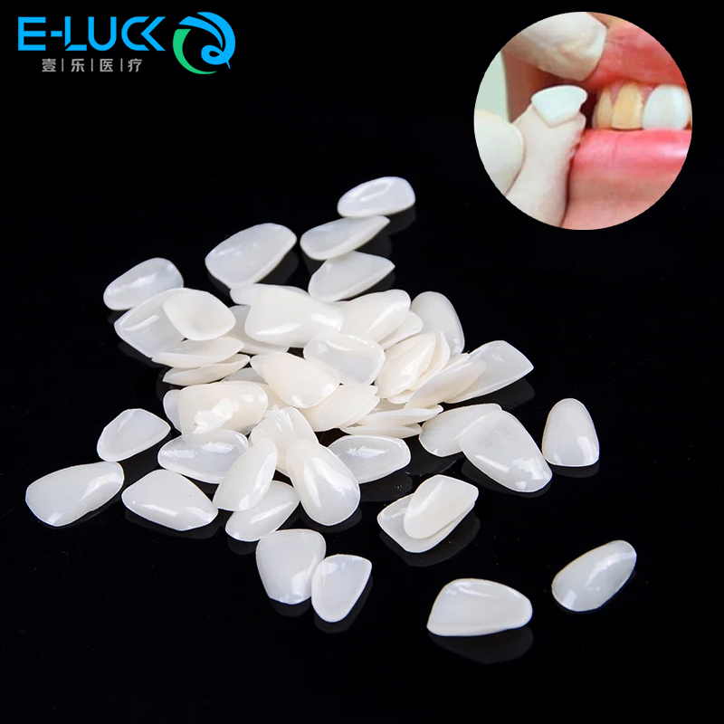 Teeth Whitening Veneers - 50 stücke Dental Zähne Veneers Temporäre
