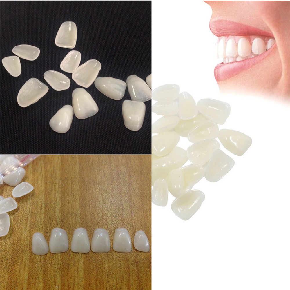 Teeth Whitening Veneers - 70 Stück/Packung Beauty Veneers Zahnaufhellung Ultradünne