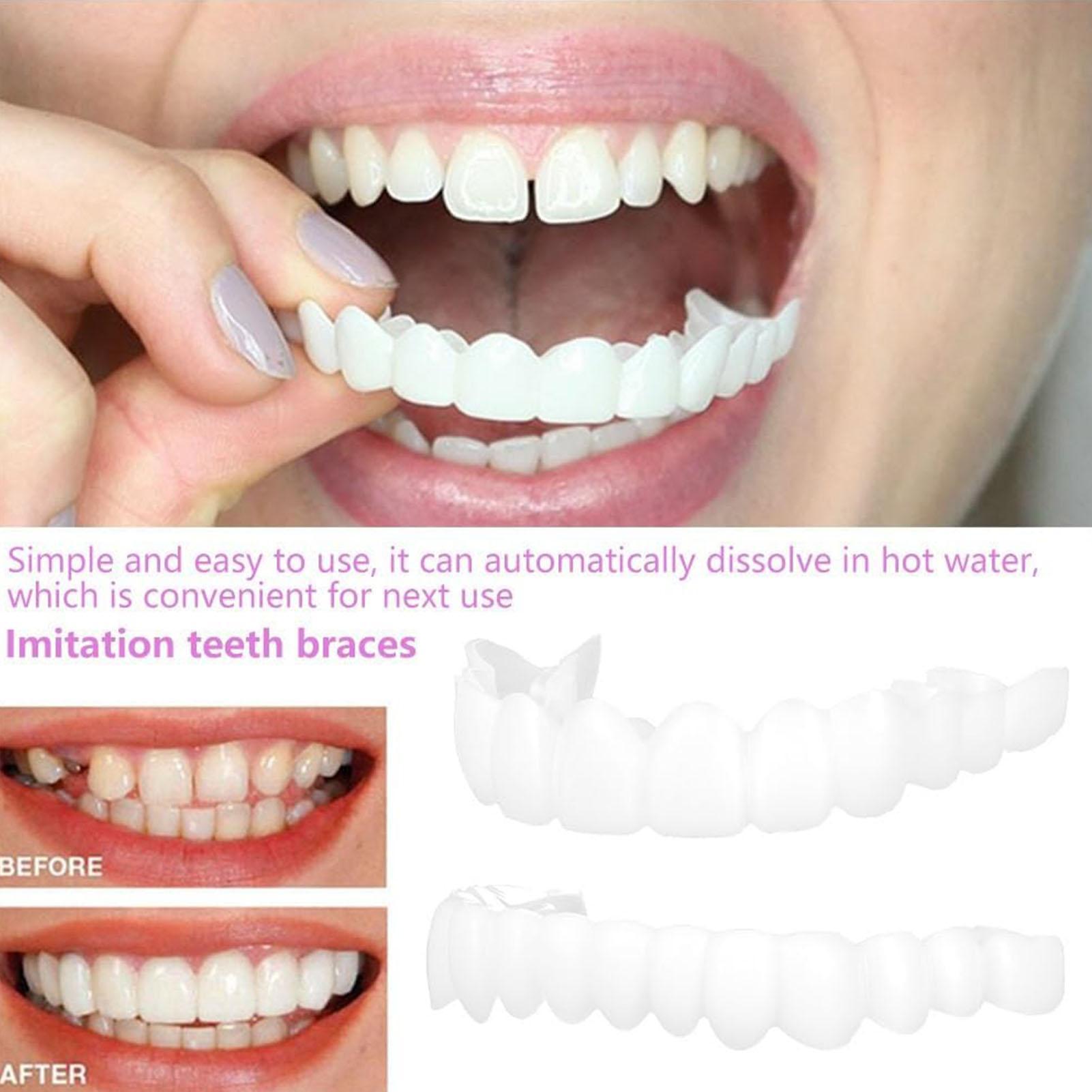 Teeth Whitening Veneers - 2 stücke Männer Frauen Temporäre Zähne