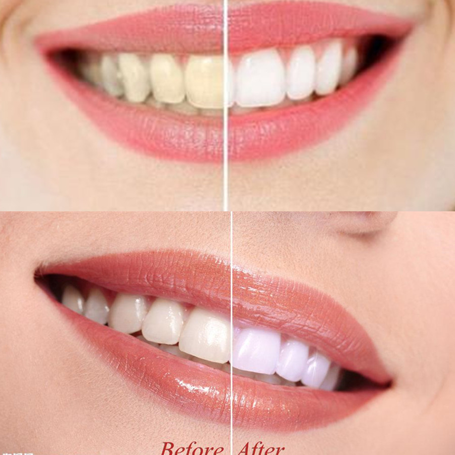Bambus Holzkohle Zähne Zahn De – Teeth Whitening Quotes Bewertung und Preis