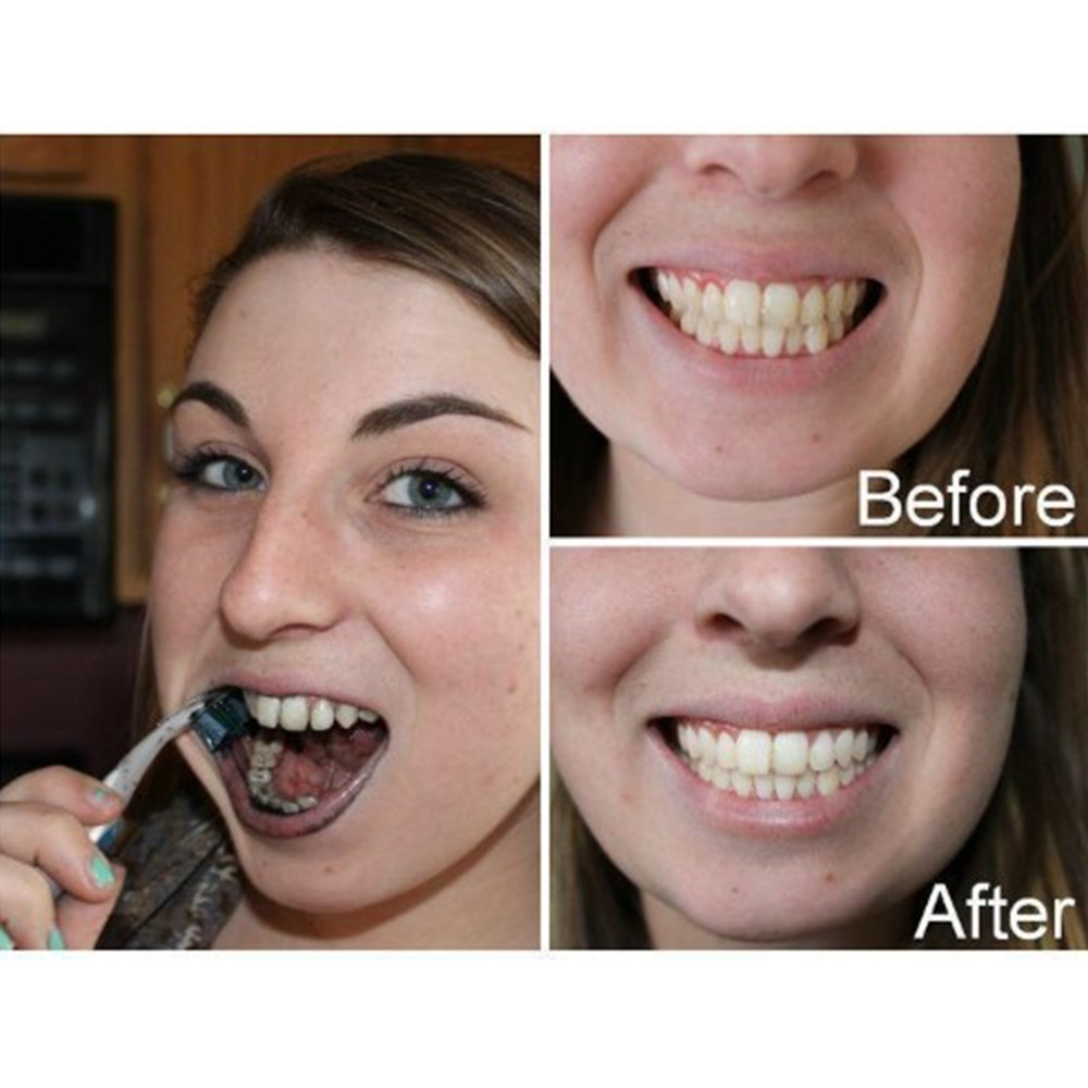Bambus Holzkohle Zähne Zahn De – Teeth Whitening Quotes Bewertung und Preis