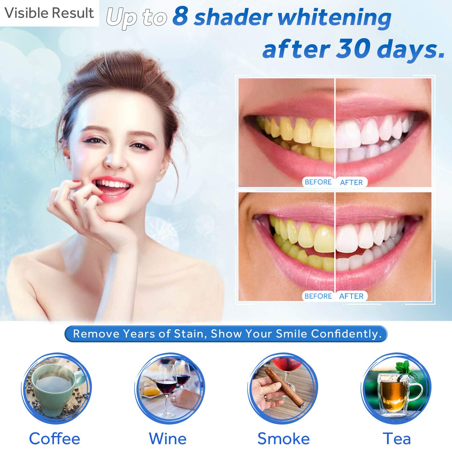 Zahnaufhellungsgel, Nachfüllsp – Teeth Whitening Diy Bewertung und Preis
