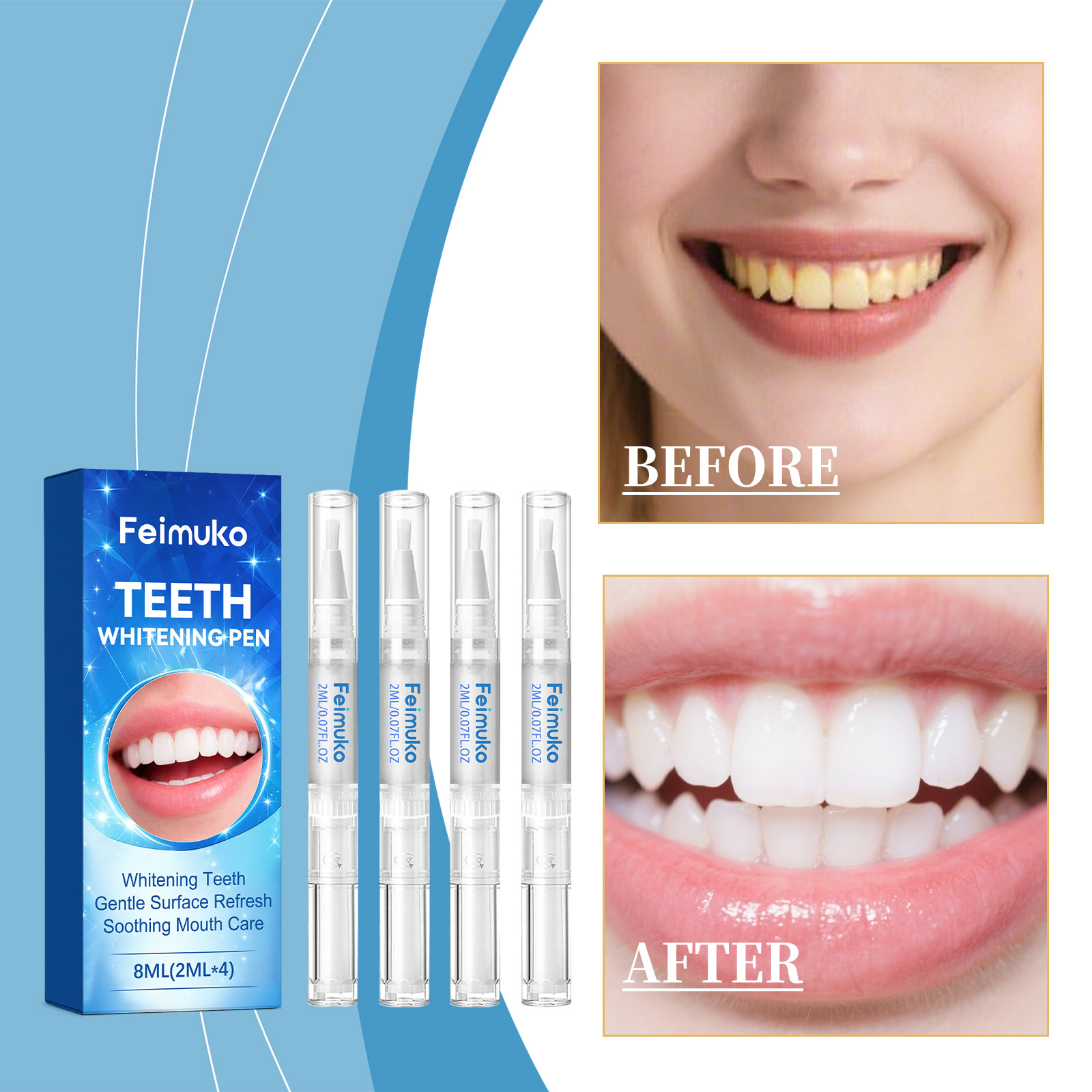 Feimuko 8ml Zahn-Gel-Stift San – Teeth Whitening Pens Bewertung und Preis