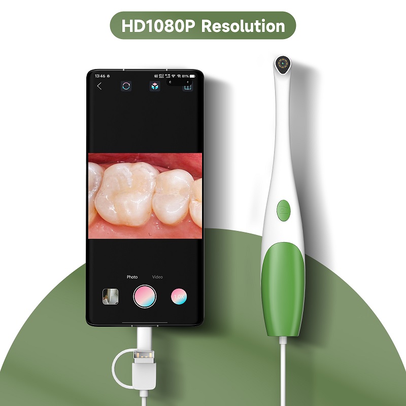 TYPE-C Oraler Endoskop Handgeh – Teeth Whitening Video Bewertung und Preis