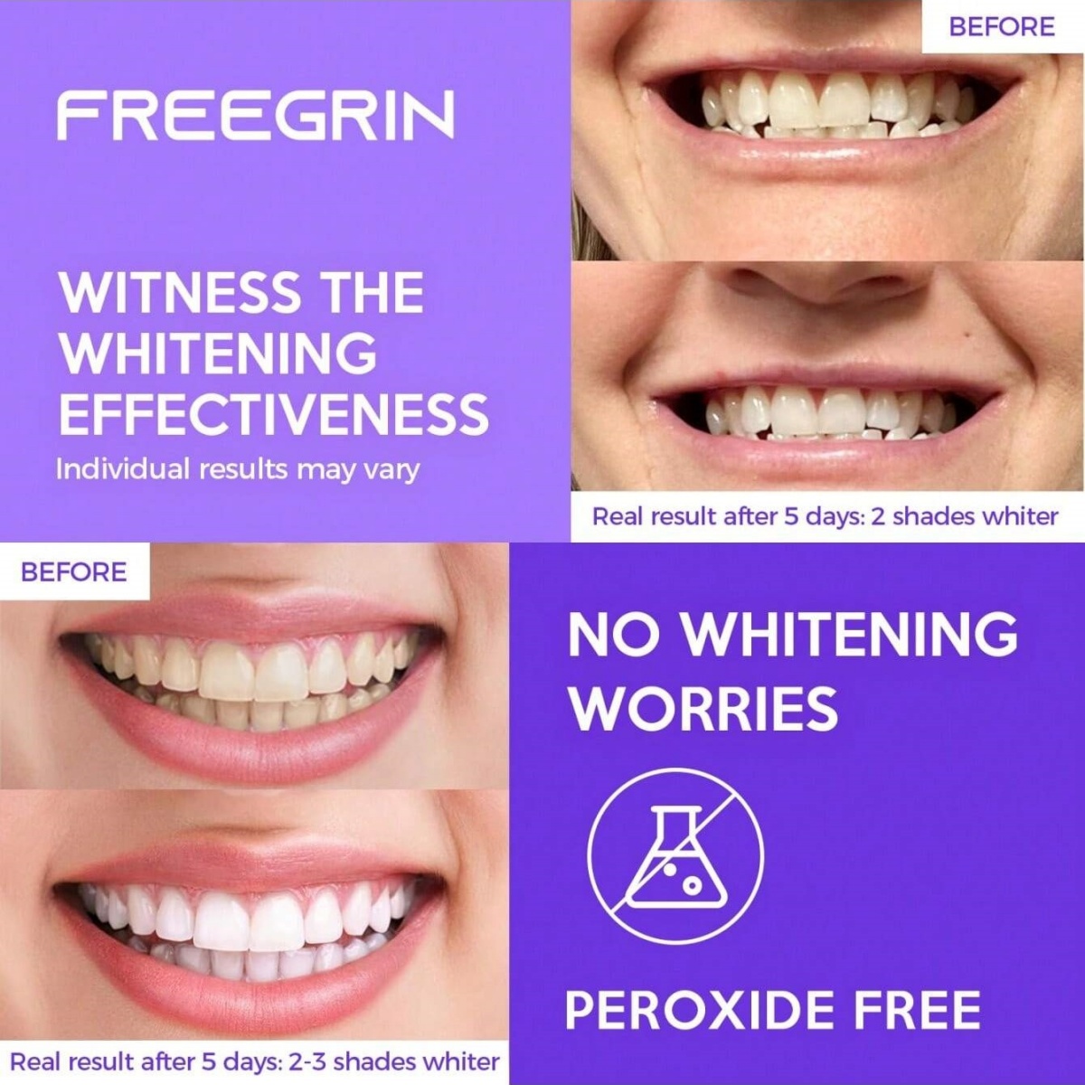 Deluxe Zahnaufhellungsaufklebe – Teeth Whitening Quotes Bewertung und Preis