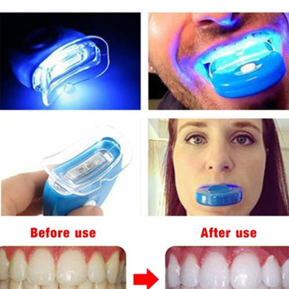 Neue Blaue Led Zähne Bleaching – Teeth Whitening Video Bewertung und Preis