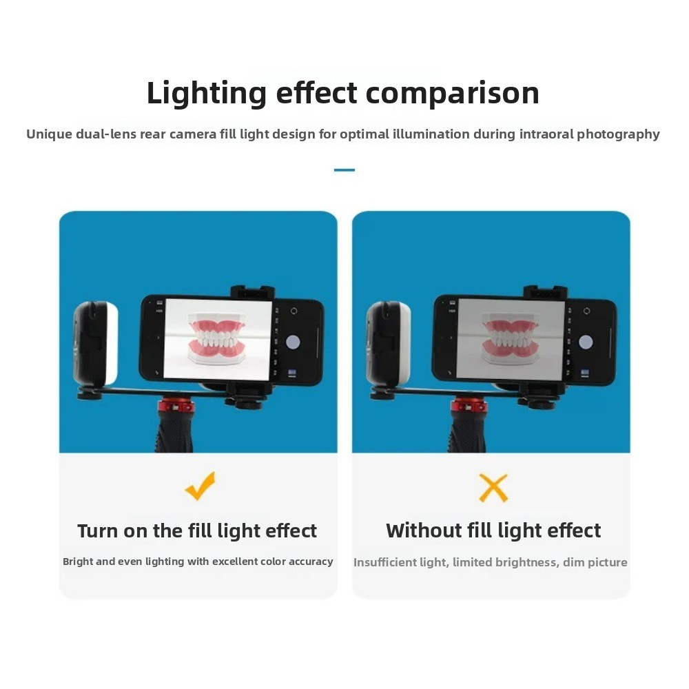 Licht für zahnärztliche Fotogr – Teeth Whitening Light Kit Bewertung und Preis
