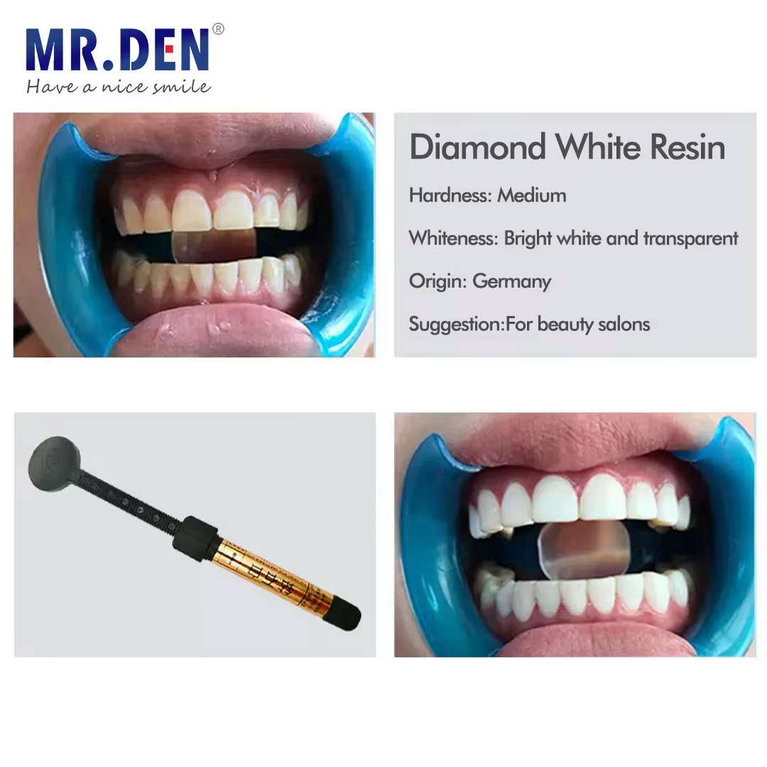 Nano-Emaille-Veneer-Material z – Teeth Whitening Veneers Bewertung und Preis