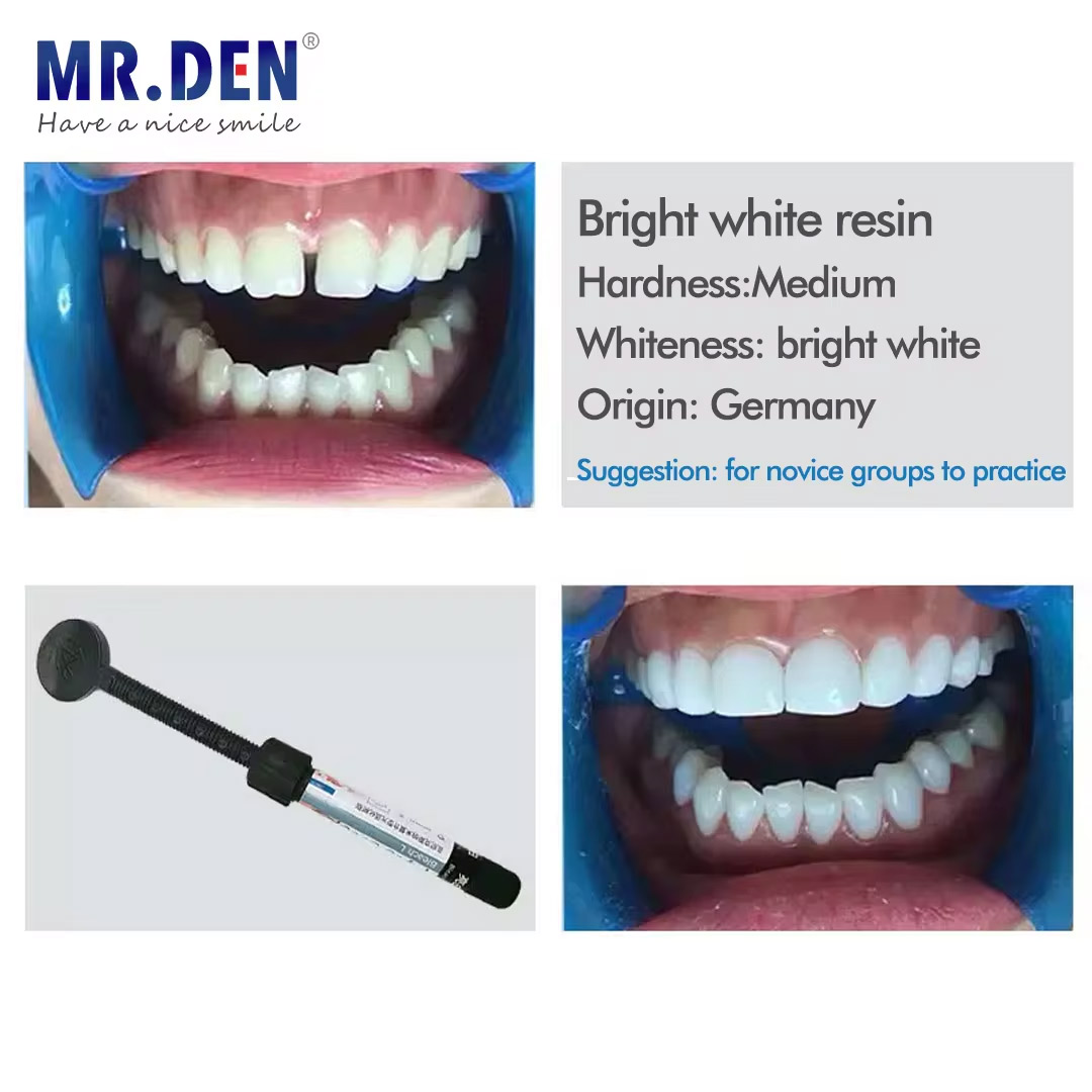 Nano-Emaille-Veneer-Material z – Teeth Whitening Veneers Bewertung und Preis