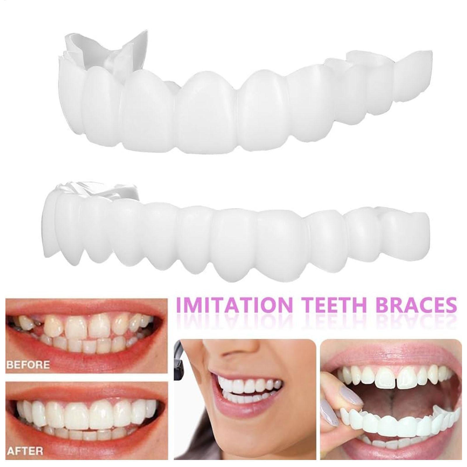 2 stücke Männer Frauen Temporä – Teeth Whitening Veneers Bewertung und Preis