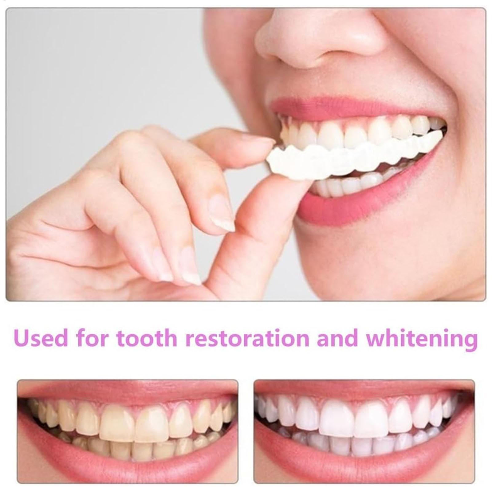 2 stücke Männer Frauen Temporä – Teeth Whitening Veneers Bewertung und Preis