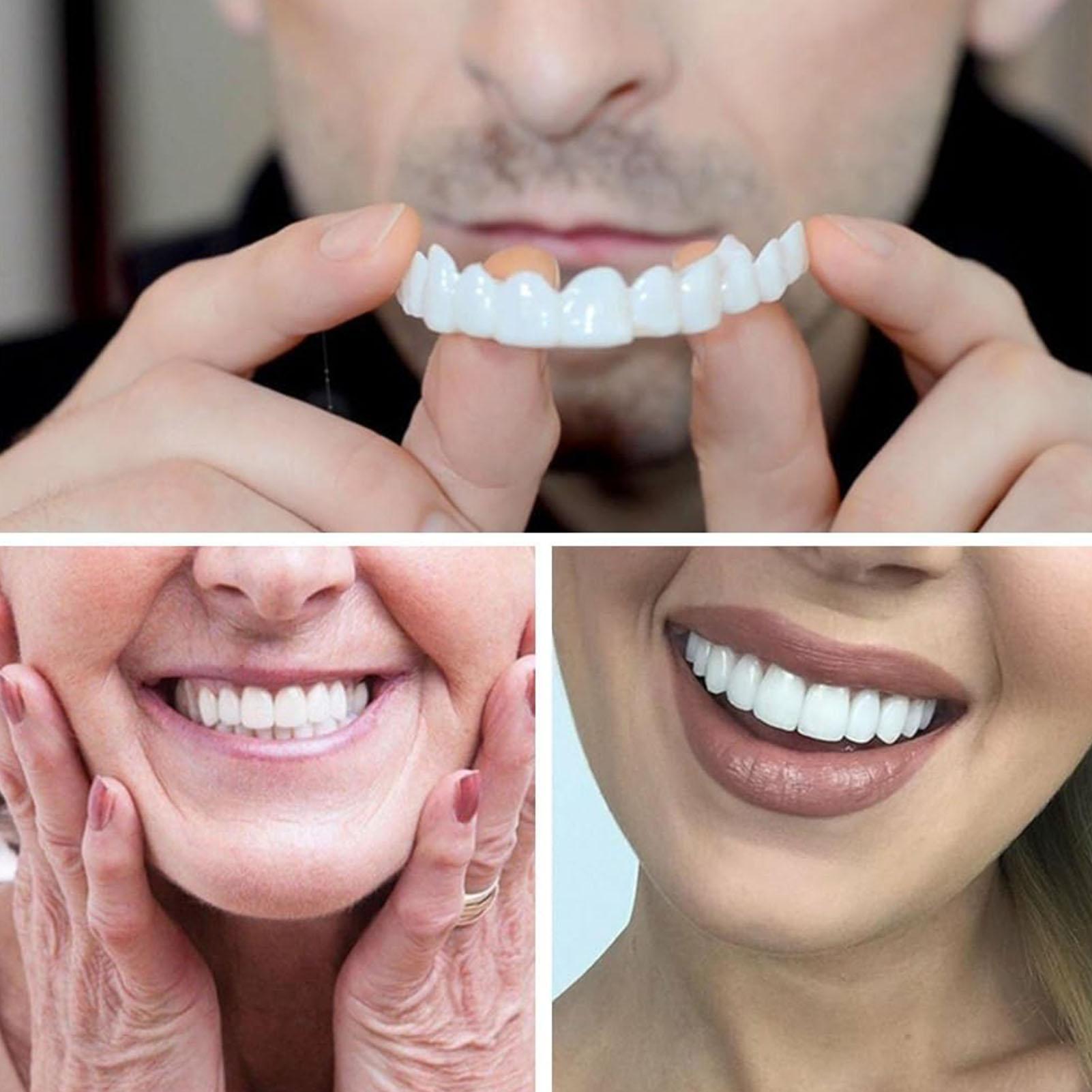 2 stücke Männer Frauen Temporä – Teeth Whitening Veneers Bewertung und Preis